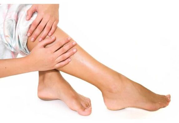 Veins Varicose