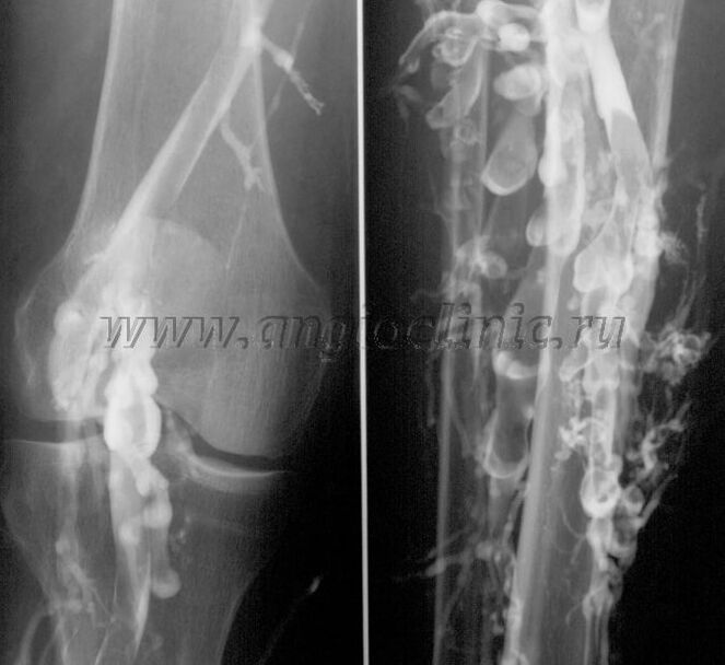 Skanandina ultrasound